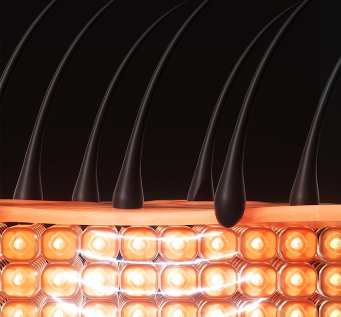 EMS Microcurrent Pulse