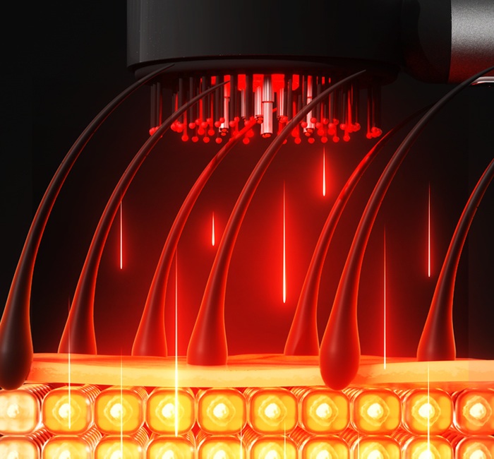 Red Light lrradiation