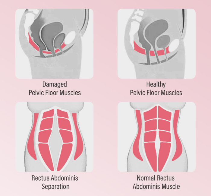 Comparison Before and After Using