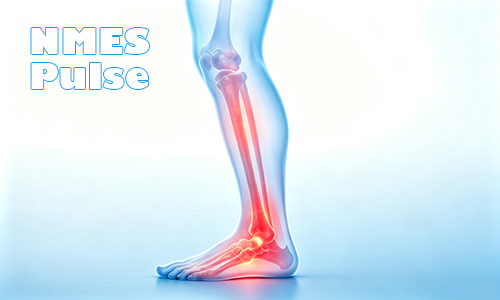 The Complete Guide to NMES Pulse Therapy